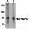 Synaptopodin antibody, MBS151009, MyBioSource, Western Blot image 