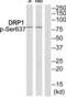 Dynamin 1 Like antibody, abx012744, Abbexa, Western Blot image 