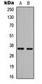 High Mobility Group 20B antibody, abx121373, Abbexa, Western Blot image 