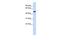 Spermatogenesis Associated 2 Like antibody, GTX45672, GeneTex, Western Blot image 