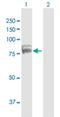 Tudor Domain Containing 3 antibody, H00081550-B01P, Novus Biologicals, Western Blot image 