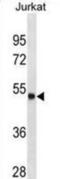 Arylsulfatase A antibody, abx025464, Abbexa, Western Blot image 