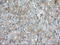 Baculoviral IAP Repeat Containing 5 antibody, GTX84824, GeneTex, Immunohistochemistry paraffin image 