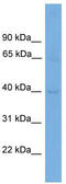 Cyclin N-Terminal Domain Containing 1 antibody, TA337789, Origene, Western Blot image 