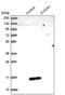 S100 Calcium Binding Protein A4 antibody, NBP1-89402, Novus Biologicals, Western Blot image 