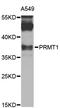 Protein Arginine Methyltransferase 1 antibody, STJ25146, St John