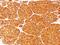 Tyrosinase antibody, GTX35154, GeneTex, Immunohistochemistry paraffin image 