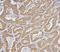 BCL2 Antagonist/Killer 1 antibody, M01163-1, Boster Biological Technology, Immunohistochemistry frozen image 