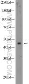 Indoleamine 2,3-dioxygenase 2 antibody, 25053-1-AP, Proteintech Group, Western Blot image 