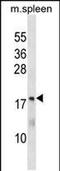 Methenyltetrahydrofolate Synthetase antibody, PA5-49053, Invitrogen Antibodies, Western Blot image 