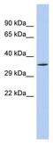 Sirtuin 4 antibody, ab90485, Abcam, Western Blot image 
