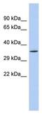 NAD-dependent ADP-ribosyltransferase sirtuin-4 antibody, ab90485, Abcam, Western Blot image 