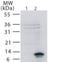 TNF Receptor Superfamily Member 12A antibody, NB100-56636, Novus Biologicals, Western Blot image 