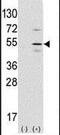 Pancreas Associated Transcription Factor 1a antibody, PA5-12265, Invitrogen Antibodies, Western Blot image 