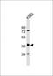 Dehydrogenase/Reductase 4 Like 2 antibody, orb2424, Biorbyt, Western Blot image 