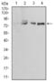 Ezrin antibody, NBP2-52464, Novus Biologicals, Western Blot image 