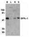 GDNF Family Receptor Alpha 1 antibody, MBS150721, MyBioSource, Western Blot image 