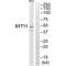 Synaptotagmin 11 antibody, A10695, Boster Biological Technology, Western Blot image 