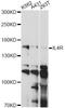 Interleukin 4 Receptor antibody, LS-C749641, Lifespan Biosciences, Western Blot image 