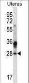 Calcium And Integrin Binding Family Member 4 antibody, LS-C168779, Lifespan Biosciences, Western Blot image 