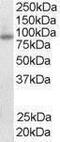 Forkhead Box O3 antibody, PA1-31322, Invitrogen Antibodies, Western Blot image 