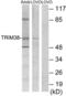 Tripartite Motif Containing 38 antibody, abx013270, Abbexa, Western Blot image 