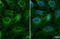 Collagen Type III Alpha 1 Chain antibody, GTX111643, GeneTex, Immunofluorescence image 