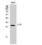 Interleukin 20 antibody, STJ93689, St John