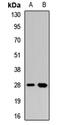 C-Type Lectin Domain Containing 7A antibody, LS-C668875, Lifespan Biosciences, Western Blot image 