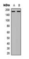 Eukaryotic Translation Initiation Factor 4 Gamma 1 antibody, orb393271, Biorbyt, Western Blot image 