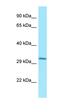 Cathepsin W antibody, orb326518, Biorbyt, Western Blot image 