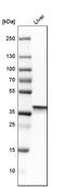 Arginase 1 antibody, HPA003595, Atlas Antibodies, Western Blot image 