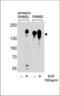 ERBB2 antibody, TA328149, Origene, Western Blot image 