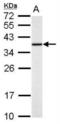 Thiosulfate Sulfurtransferase antibody, NBP2-20752, Novus Biologicals, Western Blot image 