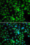 Synaptonemal Complex Central Element Protein 1 antibody, STJ29298, St John