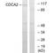 Cell Division Cycle Associated 2 antibody, A07293, Boster Biological Technology, Western Blot image 
