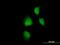 MAPK Activated Protein Kinase 2 antibody, H00009261-M10, Novus Biologicals, Immunocytochemistry image 