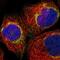Mitochondrial Fission Regulator 1 antibody, PA5-54709, Invitrogen Antibodies, Immunofluorescence image 