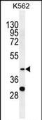 Serpin B4 antibody, PA5-71553, Invitrogen Antibodies, Western Blot image 