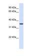 Thioredoxin Related Transmembrane Protein 2 antibody, orb325323, Biorbyt, Western Blot image 