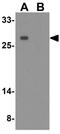 Prostate Transmembrane Protein, Androgen Induced 1 antibody, GTX32162, GeneTex, Western Blot image 