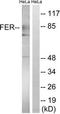 FER Tyrosine Kinase antibody, TA313868, Origene, Western Blot image 