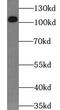 RNA Binding Motif Protein 15 antibody, FNab07163, FineTest, Western Blot image 