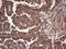 Dicer 1, Ribonuclease III antibody, LS-C789278, Lifespan Biosciences, Immunohistochemistry paraffin image 