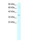 Stearoyl-CoA Desaturase antibody, PA1-24412, Invitrogen Antibodies, Western Blot image 