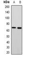 Metastasis-associated protein MTA3 antibody, abx141517, Abbexa, Western Blot image 