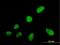 Serine And Arginine Rich Splicing Factor 5 antibody, H00006430-B02P, Novus Biologicals, Immunocytochemistry image 