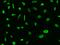 Cyclin Dependent Kinase 7 antibody, GTX02275, GeneTex, Immunocytochemistry image 