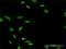 Zinc Finger Protein 71 antibody, H00058491-D01P, Novus Biologicals, Immunocytochemistry image 