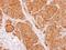 Chaperonin Containing TCP1 Subunit 2 antibody, GTX112283, GeneTex, Immunohistochemistry paraffin image 